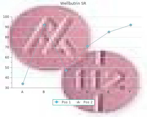 generic 150mg wellbutrin sr