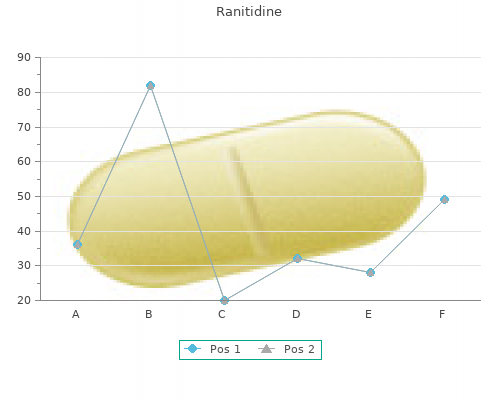 purchase 150mg ranitidine otc