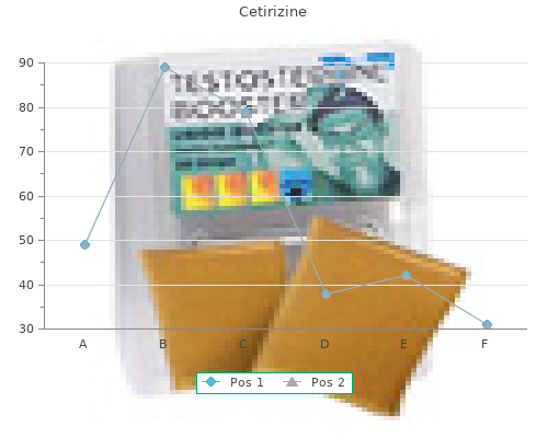 buy generic cetirizine 10mg line