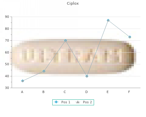 cheap 500 mg ciplox fast delivery