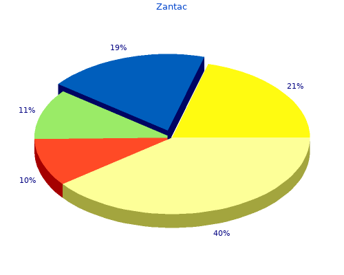 zantac 150mg cheap