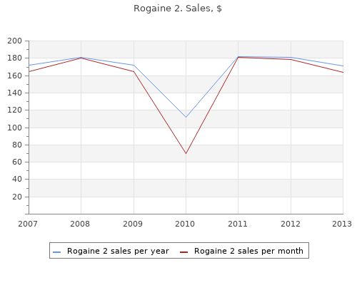 60 ml rogaine 2 amex