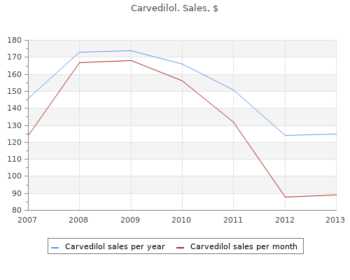 purchase carvedilol 25 mg without a prescription