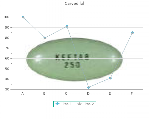discount carvedilol 25 mg overnight delivery